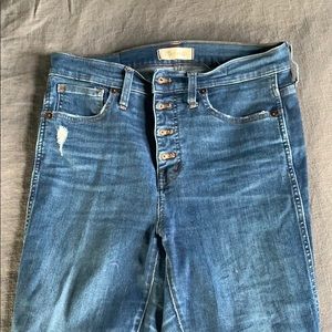 Madewell Button Fly High Rise Skinny